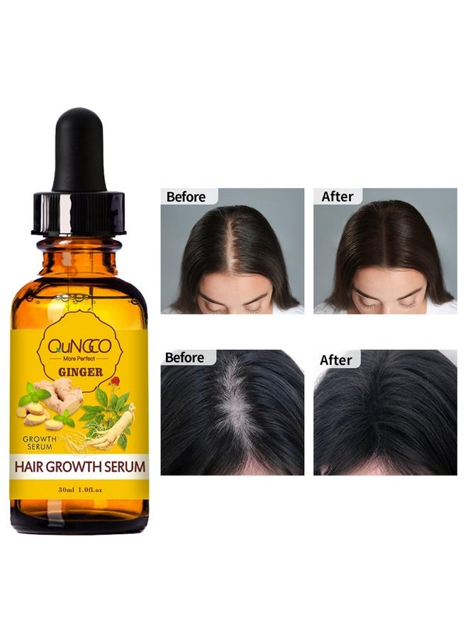 Collagen Hair Treatment Hair Mask & Hair Growth Serum,Deep Conditioner Hydrating Hair Mask for Dry Damaged Hair,Hair Growth Oil for Hair Loss,Natural Hair Regrowth Treatment for Men and Women