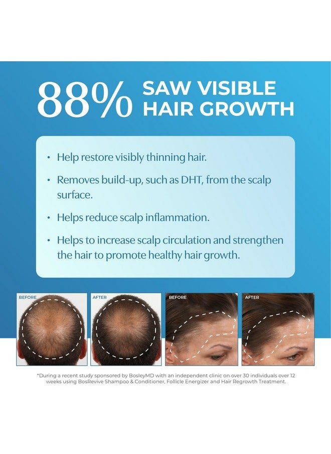 BosleyMD Professional Strength Men's Hair Re-growth Treatment, 5% Minoxidil Topical Solution, 2 Fl Oz (Pack of 2)