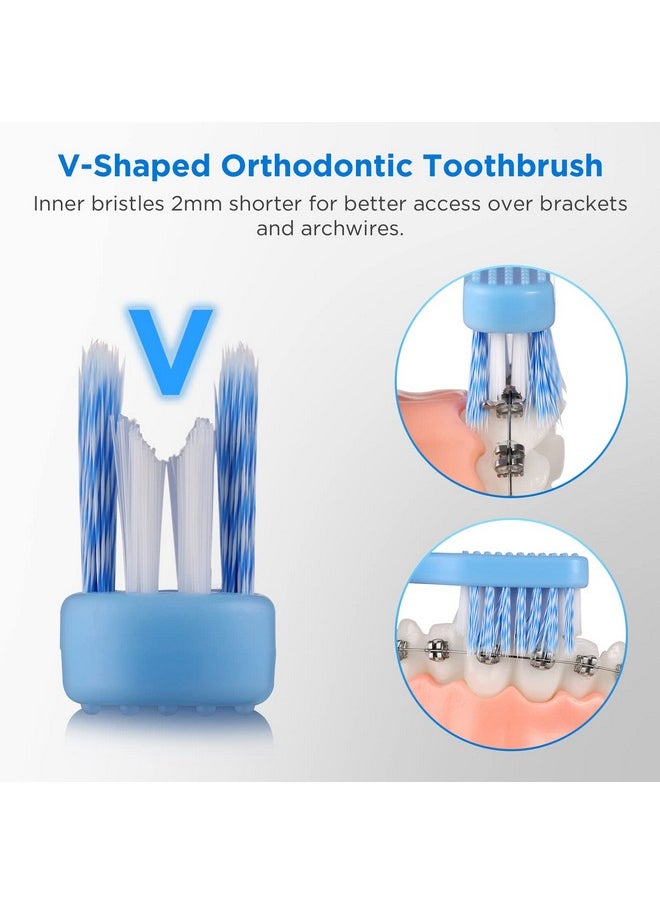 Fremouth V-Shaped Orthodontic Toothbrush for Braces, Soft Bristles, 6 Count