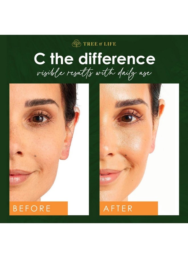 Tree of Life Beauty Vitamin C Skin Care Set, Skin Brightening Face Oil for Dark and Age Spots, Facial Serums for Dry and Sensitive Skin with Hyaluronic Acid & Vitamin E for Soft Smooth Skin, 1 Fl Oz