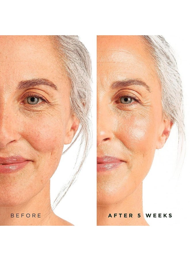 Tree of Life Beauty Retinol Serum, Skin Smoothing Face Oil for Dark and Age Spots and Fine Lines, Facial Serums for Dry and Sensitive Skin Care with Hyaluronic Acid for Soft Smooth Skin, 2 Fl Oz