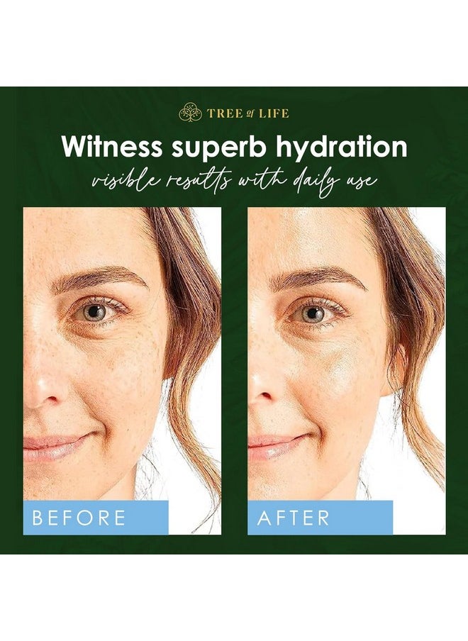 Tree of Life Beauty Hyaluronic Acid Serum, Skin Brightening Face Oil for Dark and Age Spots, Facial Serums for Dry and Sensitive Skin Care with Vitamin E for Soft Smooth Skin, 2 Fl Oz