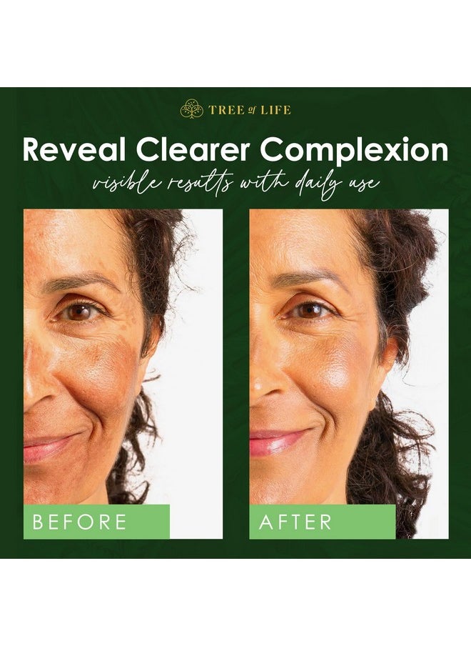 Tree of Life Beauty Niacinamide Vitamin B3 Serum, Hydrating Face Oil for Dark and Age Spots, Tightens Pores, Facial Serums for Sensitive Skin Care with Hyaluronic Acid and Vitamin E, 2 Fl Oz