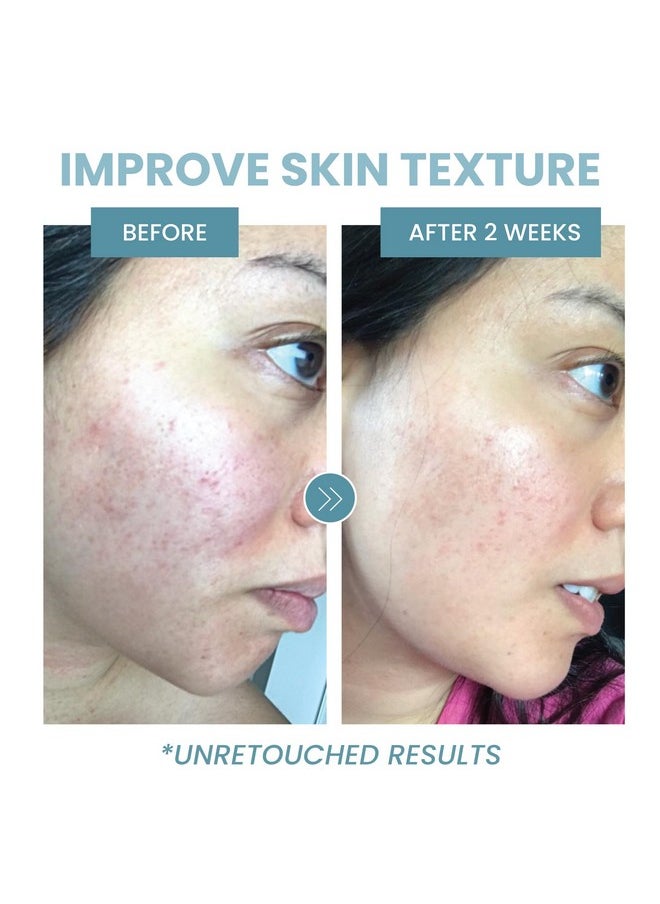 Collagen Peptide Serum - Anti Aging Collagen Serum for Face, Skin Brightening, Reduces Fine Lines & Wrinkles, Heals and Repairs Skin, Microneedling Serum with Hyaluronic Acid (2 oz)