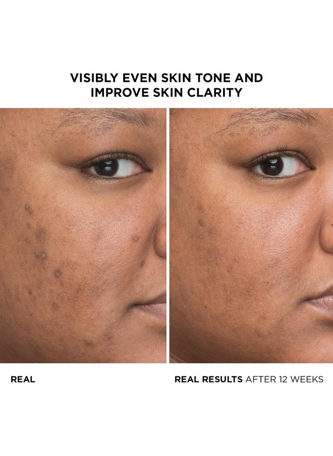IT Cosmetics Bye Bye Dark Spots 4% Niacinamide Serum - Visibly Reduces Dark Spots & Improves Skin Clarity In 8 Weeks - Facial Serum with 1% Ethyl Vitamin C - For All Skin Types - 1 Fl. Oz