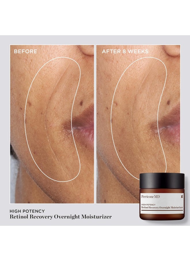 High Potency Retinol Recovery Overnight Moisturizer, 2 fl. oz.