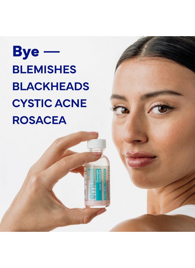 EMUAID Overnight Acne Treatment | Gentle, Fast-Acting Solution for Adults & Teens with Salicylic Acid | Clears Stubborn Pimples, Cystic Acne, Blackheads, Rosacea & Hormonal Breakouts | 1oz
