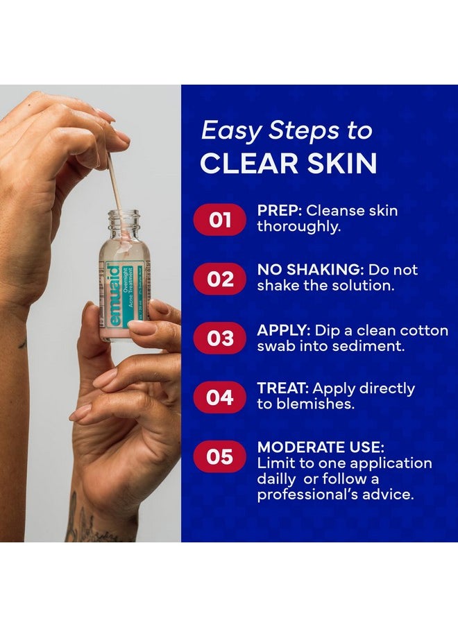 EMUAID Overnight Acne Treatment | Gentle, Fast-Acting Solution for Adults & Teens with Salicylic Acid | Clears Stubborn Pimples, Cystic Acne, Blackheads, Rosacea & Hormonal Breakouts | 1oz
