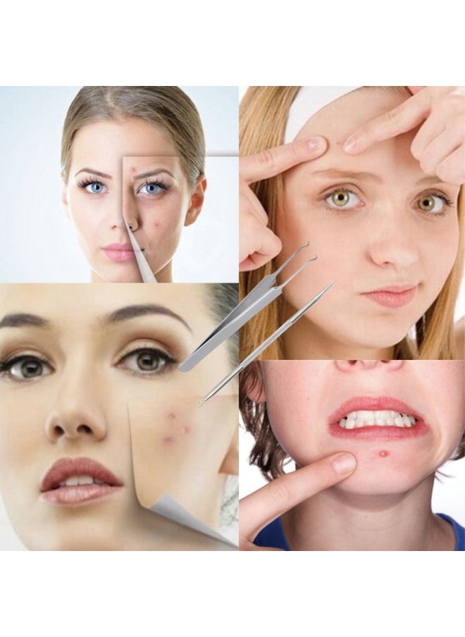 FIXBODY Blackhead and Splinter Remover Tools - Stainless Steel Professional Easily Cure Pimples Whiteheads Comedones Acne Zit Ingrown Hairs and Facial Impurities Bend Head Tweezer Surgical Kit