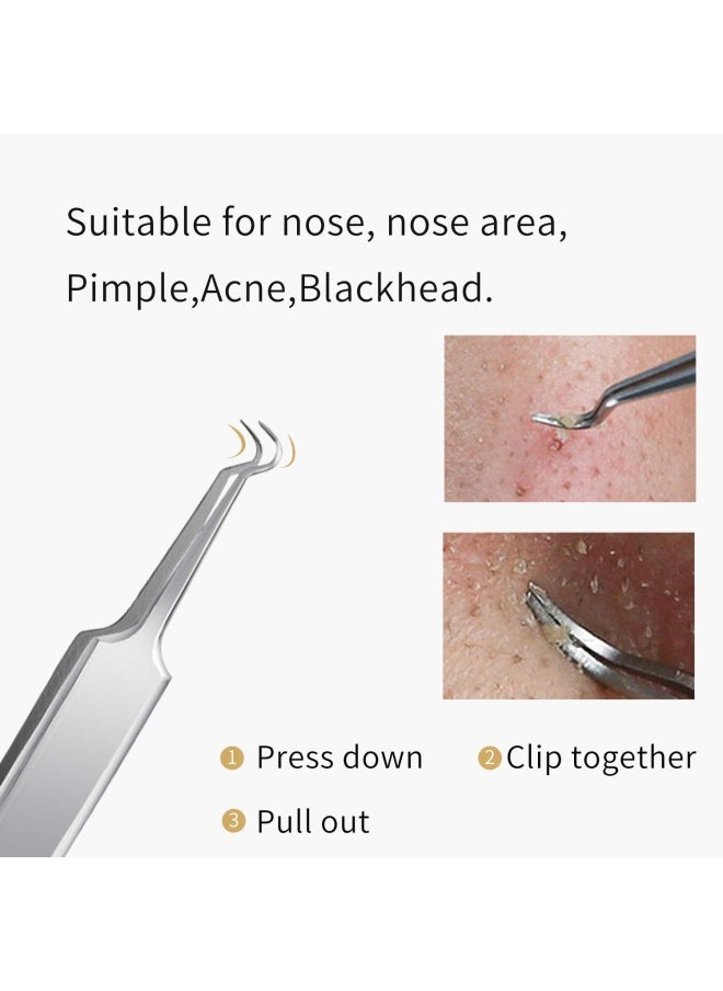 FIXBODY Blackhead and Splinter Remover Tools - Stainless Steel Professional Easily Cure Pimples Whiteheads Comedones Acne Zit Ingrown Hairs and Facial Impurities Bend Head Tweezer Surgical Kit
