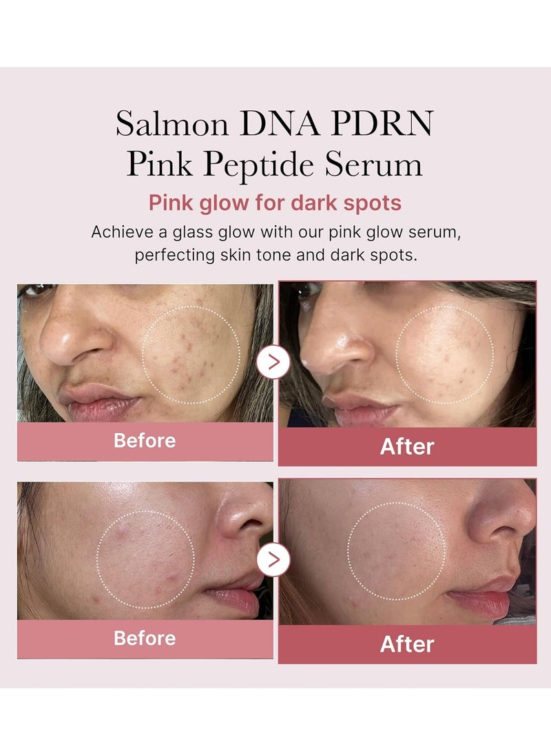 Sodium DNA PDRN Pink Peptide Serum, Pink Glow Serum, Peptide, Niacinamide, Hydrating & Moisturizing & Firming, Uneven Skin Tone, Korean Skincare | 1.01 fl.oz.