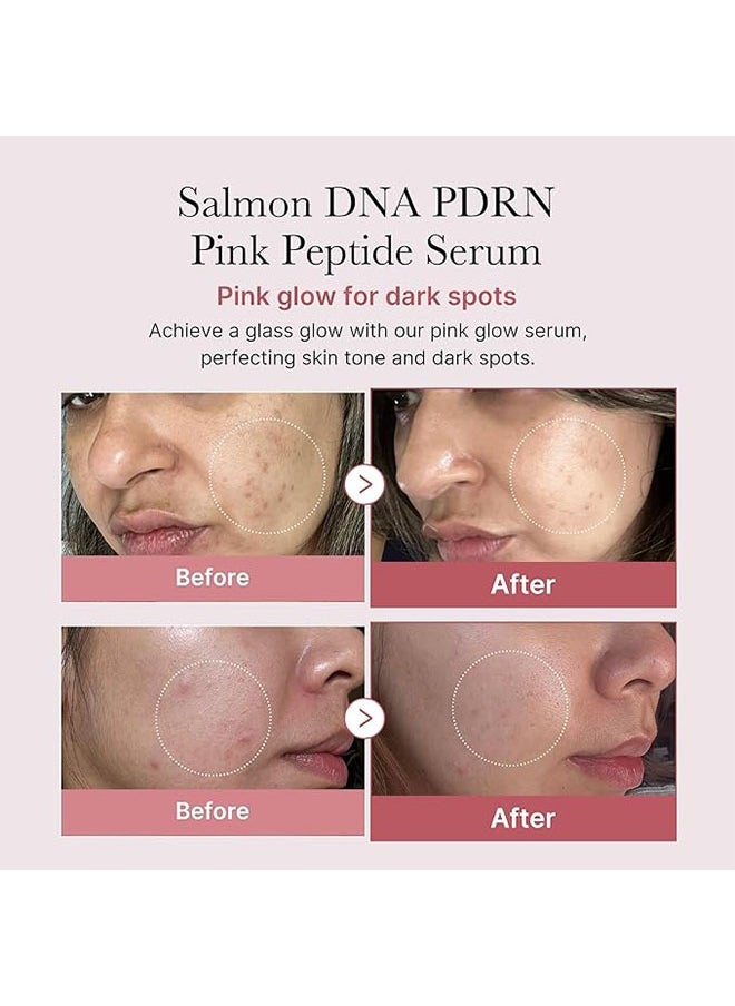 ROSE PDRN  Pink Peptide Serum- Dark Spot Care,Even Skin Tone, PDRN (Sodium DNA)1%, 5 Types Peptide Complex-PDRN Salmon, Pink glow serum, Peptide, Niacinamide, Hydrating & Moisturizing  30ml