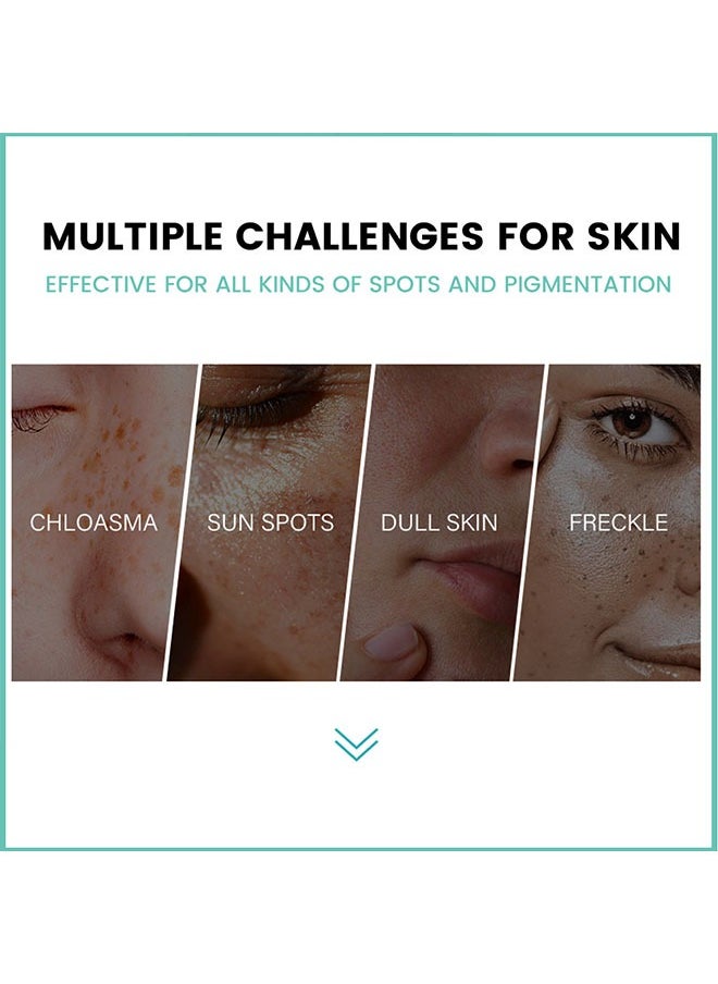 Melasma Relief Cream-(Relieve Dark Spot+Whitening&Brightening+100%Natural Ingredients) Hyperpigmentation, Melasma, Freckles, Sun Spots - For All Skin Types 20g