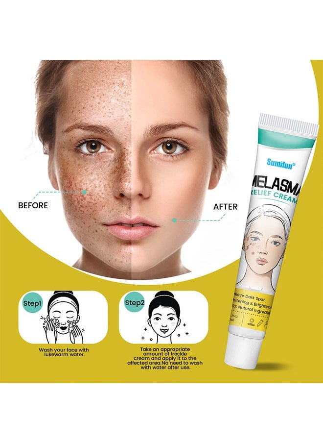 Melasma Relief Cream-(Relieve Dark Spot+Whitening&Brightening+100%Natural Ingredients) Hyperpigmentation, Melasma, Freckles, Sun Spots - For All Skin Types 20g