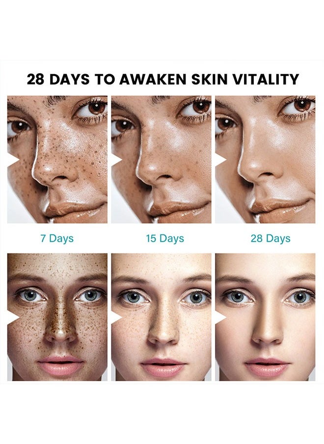 Melasma Relief Cream-(Relieve Dark Spot+Whitening&Brightening+100%Natural Ingredients) Hyperpigmentation, Melasma, Freckles, Sun Spots - For All Skin Types 20g