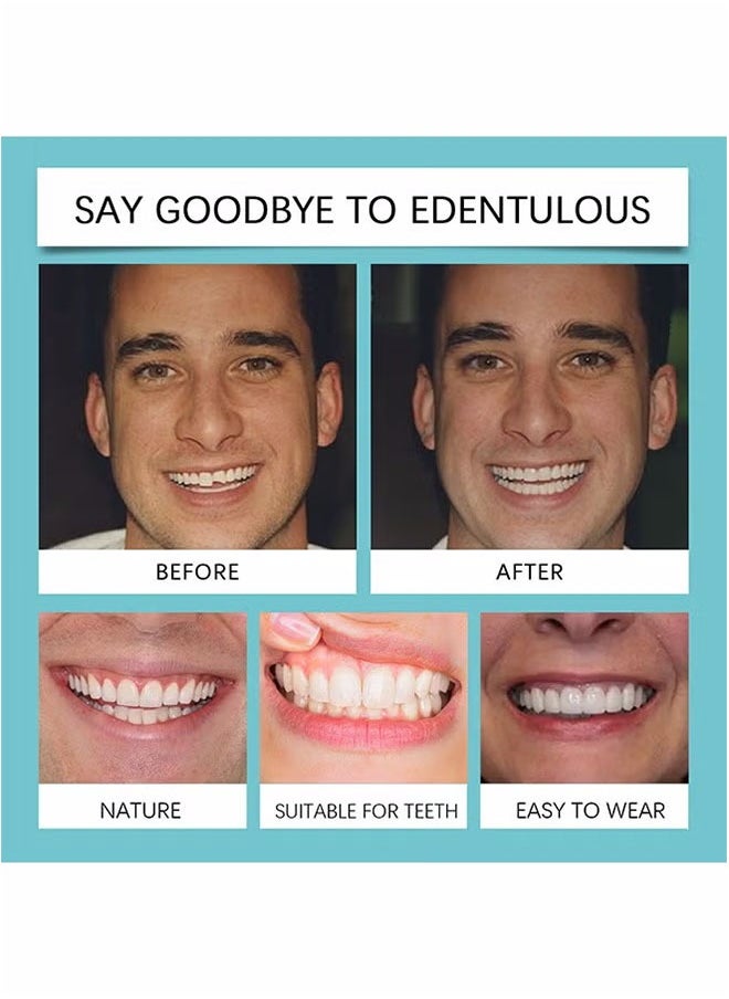 Veneers False Teeth, Adjustable Snap-On Braces, Comfortable Temporary Dental Restoration Kit