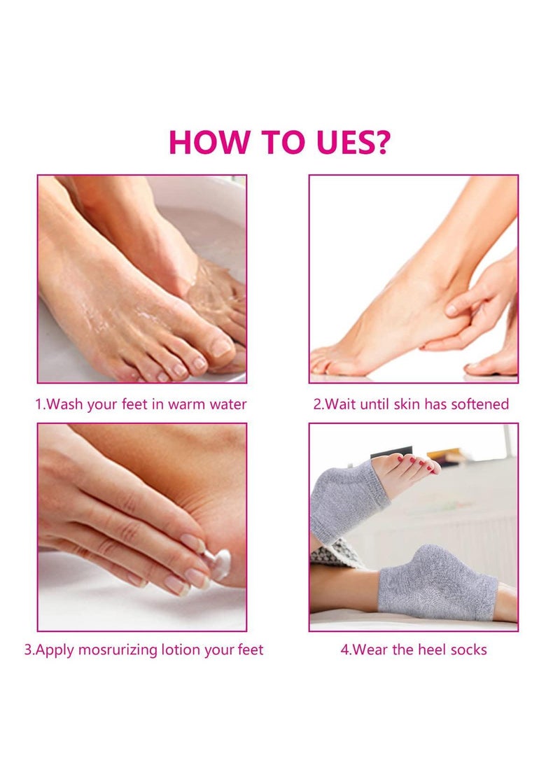 3 Pairs of Toeless Moisturizing Gel Heel Socks - Repair Dry, Cracked Feet - Open Toe Socks for Women