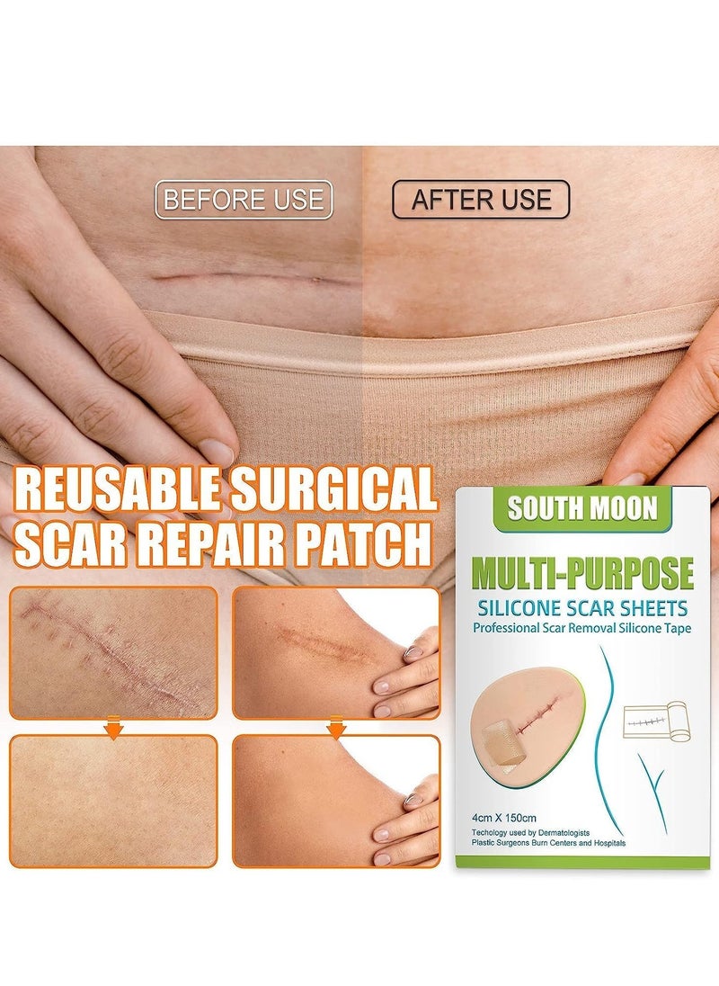 Multi Purpose Silicone Scar Sheets Medical Grade Silicone Roll -150cm,Silicone Scar Tape Keloid,C-Section,Surgical Scars Removal Scar Roll Silicon Gel Cream Patch Removes Abs Tuck Surgery Scars Scar Removal Strips