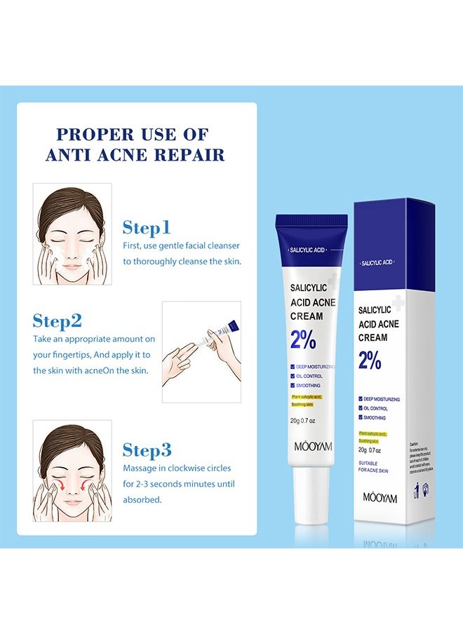 Salicylic Acid Acne Cream, Deep Moisturizing Oil Control Smoothing Acne Cream with 2% Salicylic Acid, Soothing Cream for Acne Skin Hydrating Oil Control Pore Tightening Acne Cream, 20g