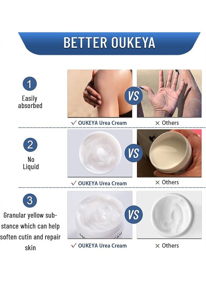40 Percent Urea Cream 150g, Intensively Moisturize And Nourish The Hand And Feet Skin, Urea Foot and Hand Cream for Dry Cracked