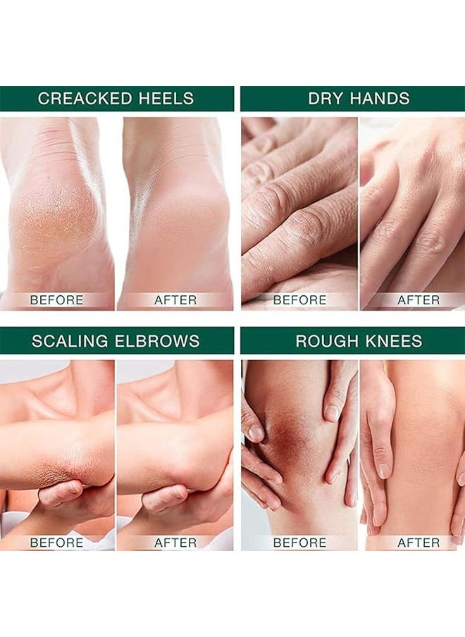 40 Percent Urea Cream 150g, Intensively Moisturize And Nourish The Hand And Feet Skin, Urea Foot and Hand Cream for Dry Cracked