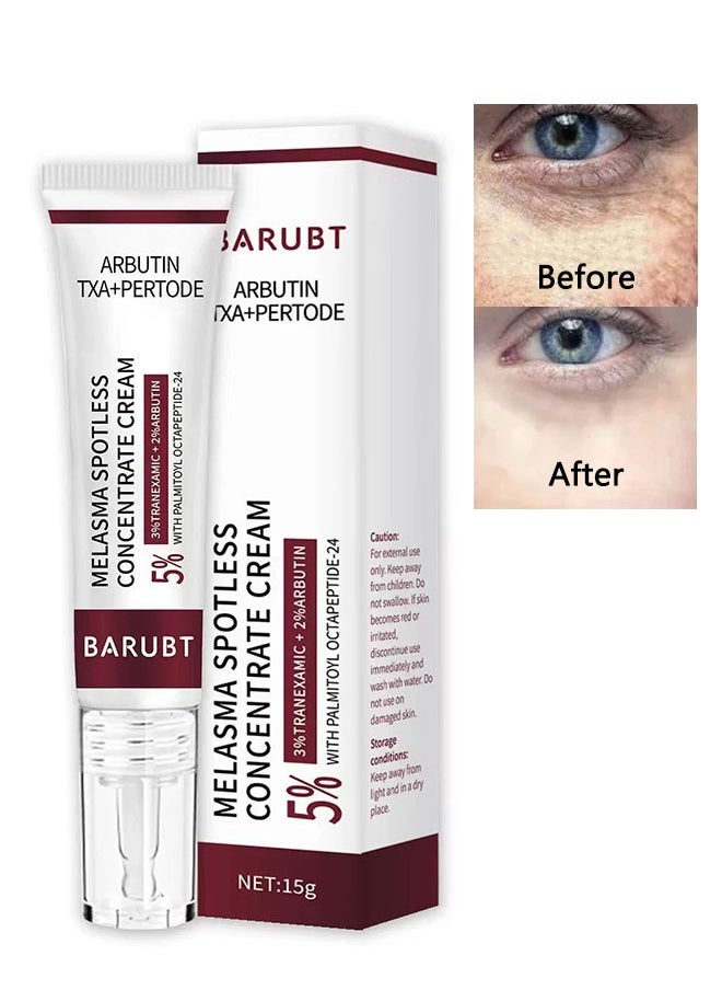 Melasma Spotless Concentrate Cream 15g, Moisturizing Hydrating and Firming Cream for Dark Spot, Melasma, Age Spots, Freckle Remover Cream, Reduce Dark Circles and Fine Lines