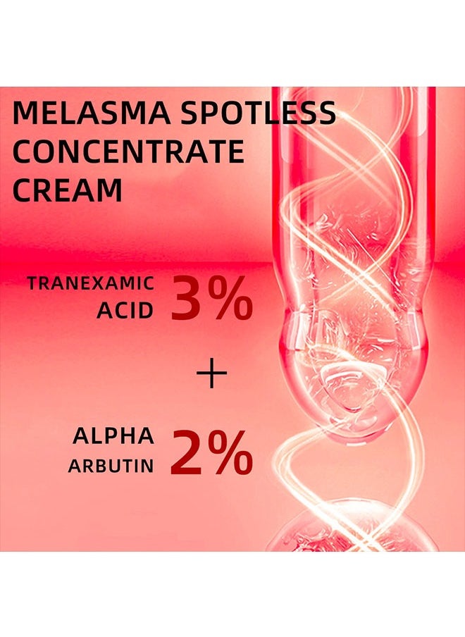 Melasma Spotless Concentrate Cream 15g, Moisturizing Hydrating and Firming Cream for Dark Spot, Melasma, Age Spots, Freckle Remover Cream, Reduce Dark Circles and Fine Lines