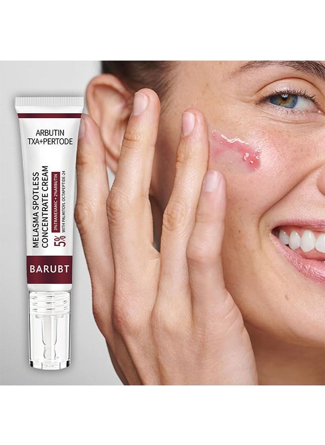 Melasma Spotless Concentrate Cream 15g, Moisturizing Hydrating and Firming Cream for Dark Spot, Melasma, Age Spots, Freckle Remover Cream, Reduce Dark Circles and Fine Lines