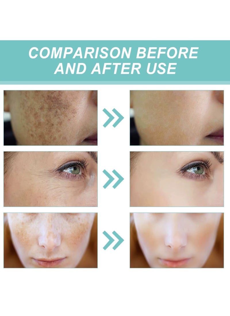 2 Pcs Dark Spot Corrector (30g x 2)
