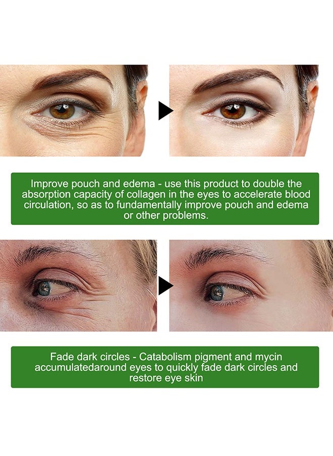 30 Pairs Seaweed Eye Mask - Under Eye Patches with Collagen and Hyaluronic Acid, Seaweed Tightening Eye Mask - Hydrating Green Eye Gel Pads for Puffy Eyes, Wrinkles, Dark Circles and Bags Under Eyes