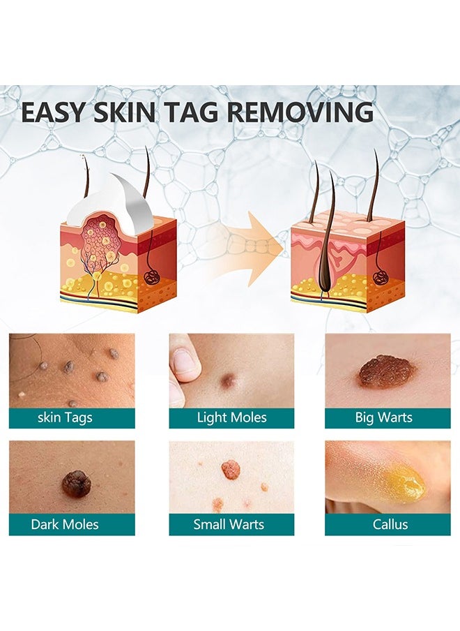 Skin Tag Remover Cream- Painless Natural Formula, Smoothes Skin Gentle Fast Acting Gel Wart Removal For Plantar Wart Flat Warts And Corns, 100 % Natural Herbal 100g