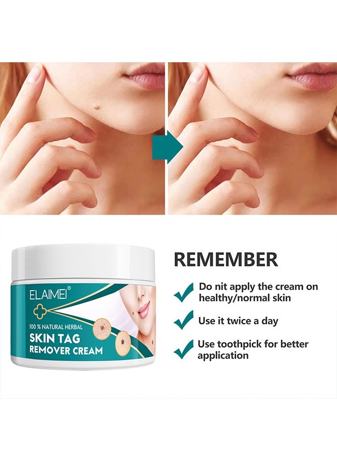 Skin Tag Remover Cream- Painless Natural Formula, Smoothes Skin Gentle Fast Acting Gel Wart Removal For Plantar Wart Flat Warts And Corns, 100 % Natural Herbal 100g