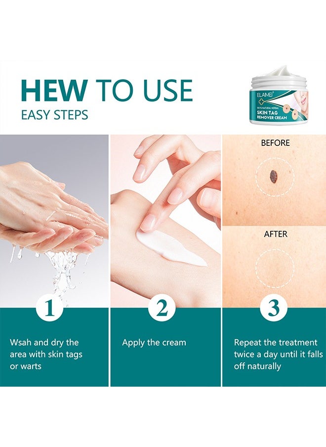 Skin Tag Remover Cream- Painless Natural Formula, Smoothes Skin Gentle Fast Acting Gel Wart Removal For Plantar Wart Flat Warts And Corns, 100 % Natural Herbal 100g