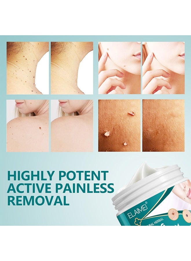 Skin Tag Remover Cream- Painless Natural Formula, Smoothes Skin Gentle Fast Acting Gel Wart Removal For Plantar Wart Flat Warts And Corns, 100 % Natural Herbal 100g