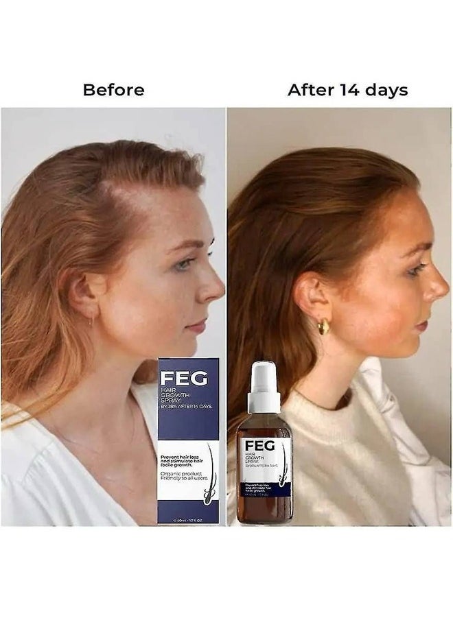 FEG Hair Growth Spray BY 38% AFTER 14 DAYS