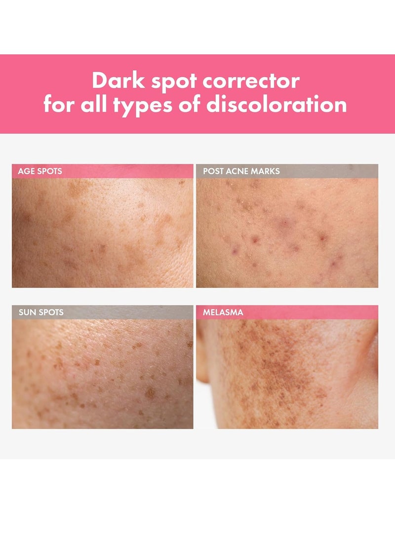 Arbutin 7% Intensive Spot Cream with 70,000ppm Arbutin, 3% Tranexamic Acid, 1% Niacinamide, Glutathione, Dark Spots, freckle, Blemishes, Anti-pigmetation, Korean Skin Care, 20ml, 0.67 fl.oz
