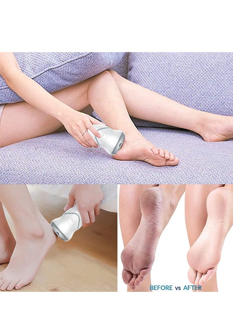 Automatic Electric Foot File – At-Home Pedicure Machine for Dead Skin & Callus Removal, Foot Care Tool for Soft, Beautiful Feet