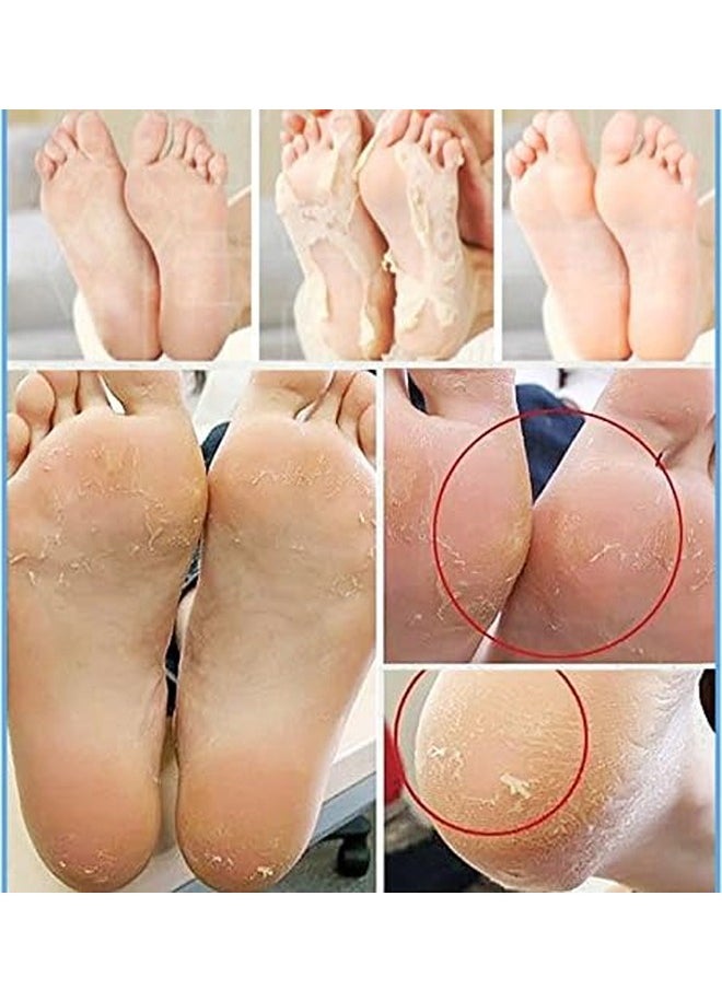 Exfoliating Magic Foot pack of 2