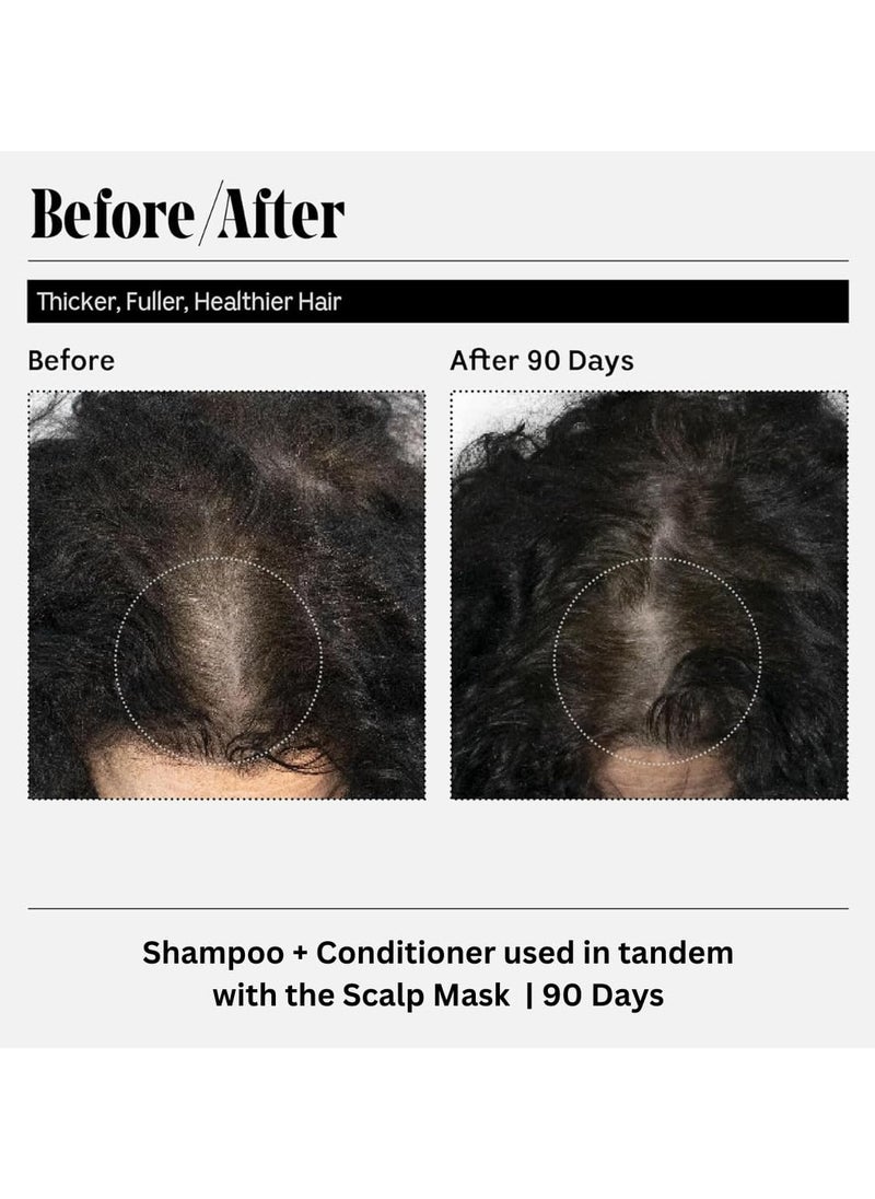 Hairfall Control Shampoo, Reduces Hair Fall & Strengthens Roots, Promotes Hair Growth & Adds Volume, For All Hair Types, Men & Women - 200ml