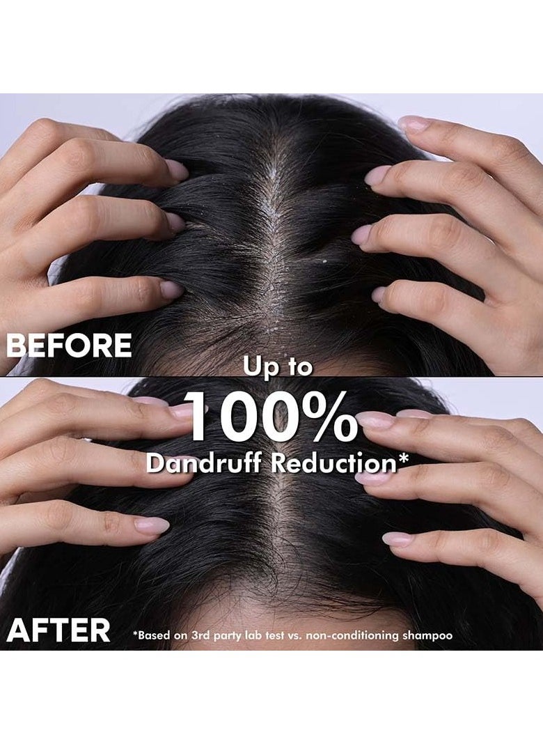 Dandruff Defence Shampoo with Tea Tree Oil & Cactus Extracts | Prevents Dandruff | Paraben and Sulphate Free Shampoo (370ml)