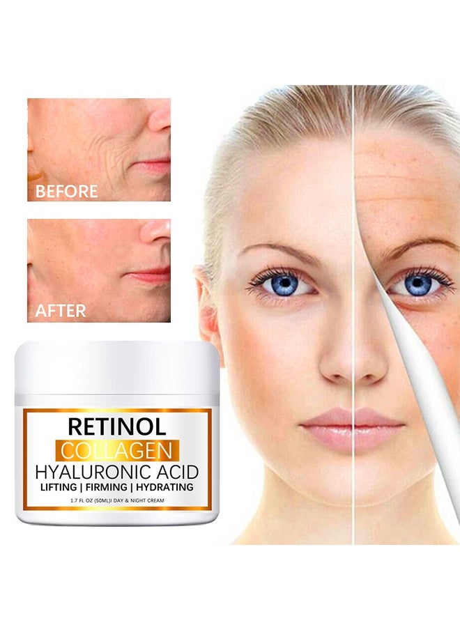 Retinol Collagen Hyaluronic Acid，Cream for Face, Anti-Aging Moisturizer with Hyaluronic Acid & Vitamin E, Collagen Cream for Wrinkles & Dark Spots, Night Cream for Youthful Skin (50g)
