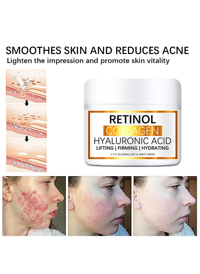Retinol Collagen Hyaluronic Acid，Cream for Face, Anti-Aging Moisturizer with Hyaluronic Acid & Vitamin E, Collagen Cream for Wrinkles & Dark Spots, Night Cream for Youthful Skin (50g)