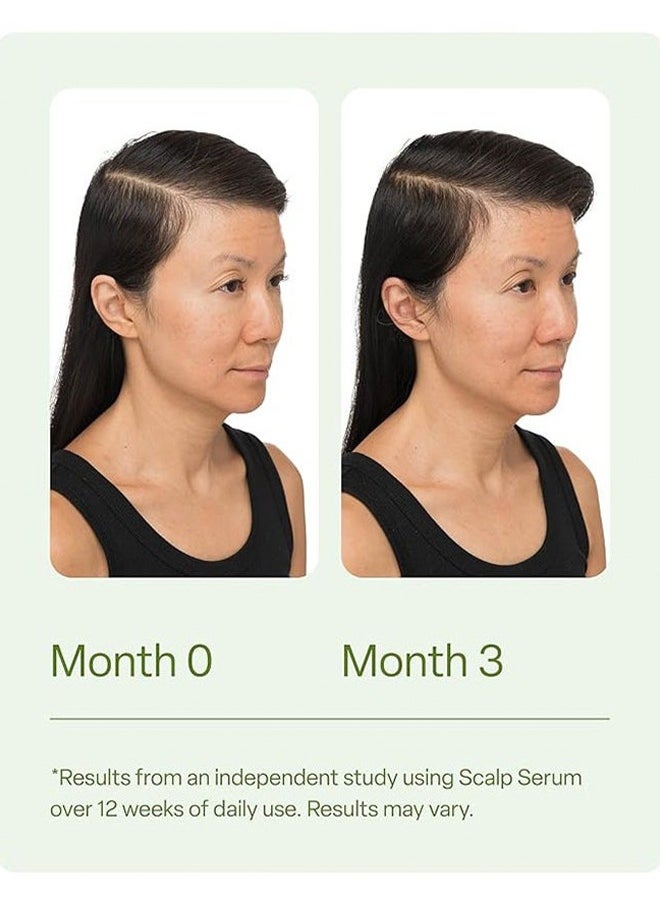 Scalp Serum Revitalize and detoxify - Improves Appearance of Thin Hair, Nourishes Hair Follicles, Detoxifies Product Build Up for Man and Women, Promotes Healthy Scalp and Fuller