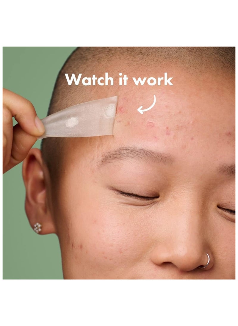 Mighty Patch Surface - Hydrocolloid Large Acne Pimple Patch Spot Treatment (10 count) for Body and Larger Breakouts on Cheek, Forehead, Chin, Vegan, Cruelty-Free, 50% Better Absorption