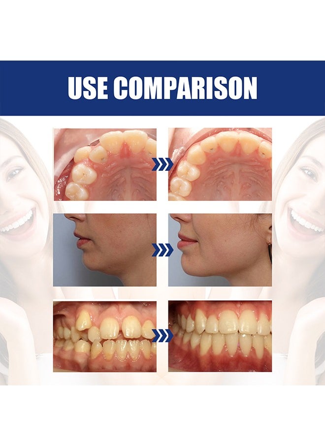 Jaw Adjustment Bracket - Teeth Aligners for Straightening Teeth - Correcting Chin Retraction - Crooked Teeth - Malformed Buck Teeth - Oral Care Brace - Bruxism Night Guard