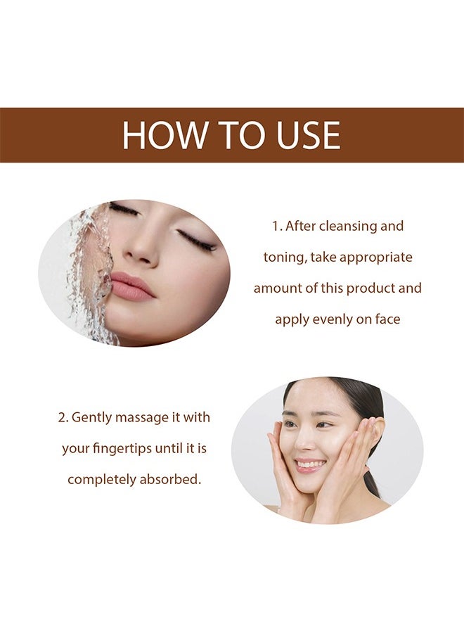 Niacinamide Anti Freckle Serum，Niacinamide Spot Correcting Serum | Hydrating, Skin Brightening, Dark Spot Fading & Skin Rejuvenating Essence 30ml