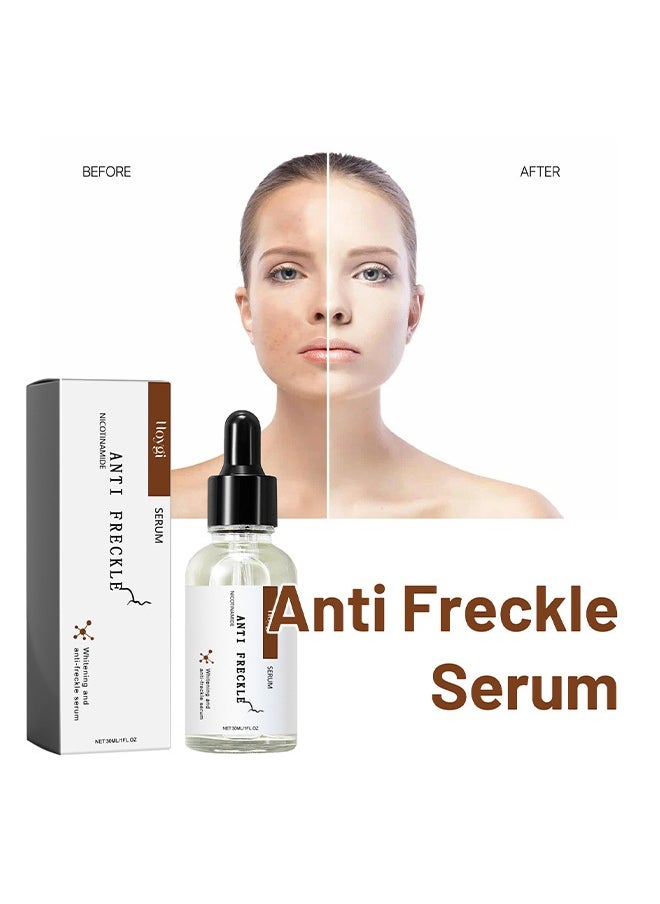 Niacinamide Anti Freckle Serum，Niacinamide Spot Correcting Serum | Hydrating, Skin Brightening, Dark Spot Fading & Skin Rejuvenating Essence 30ml