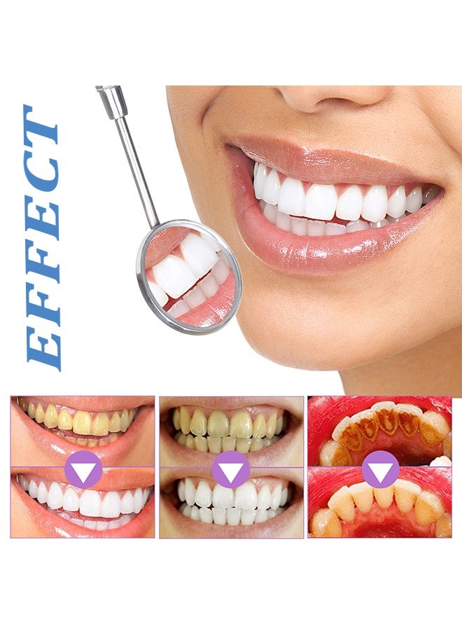 5D White Teeth Whitening Strips— Oral Hygiene Care Strip -for false Teeth Dental Bleaching System Gel （7 Sets）