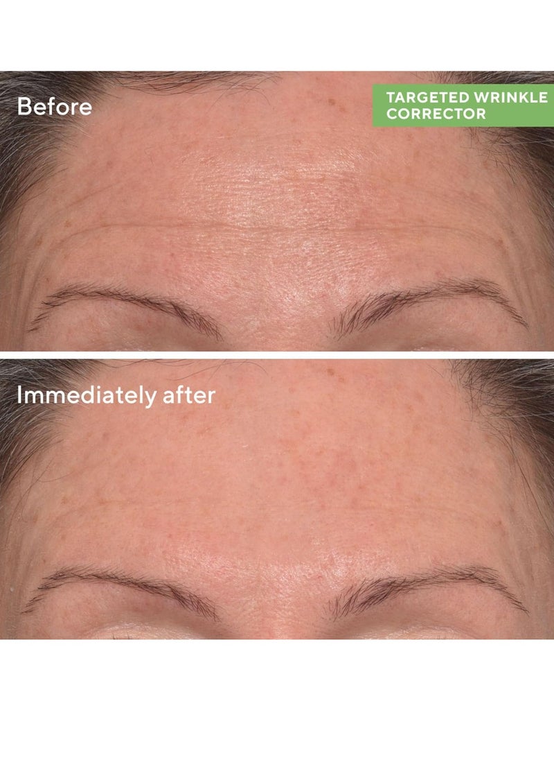Murad Targeted Wrinkle Corrector - Resurgence Anti-Wrinkle Face Cream - Instant Filler Wrinkle Corrector - Gentle Anti-Aging Hydrating Hyaluronic Acid Treatment Backed by Science, 0.5 Oz
