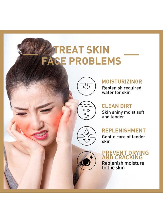 Rice Toner, 77.78% Rice Extract, Effectively Replenish Nutrients Improve Dryness Soften Cuticles Minimize Poreslighten Acne Scars Soothe And Repair Skin 150ML